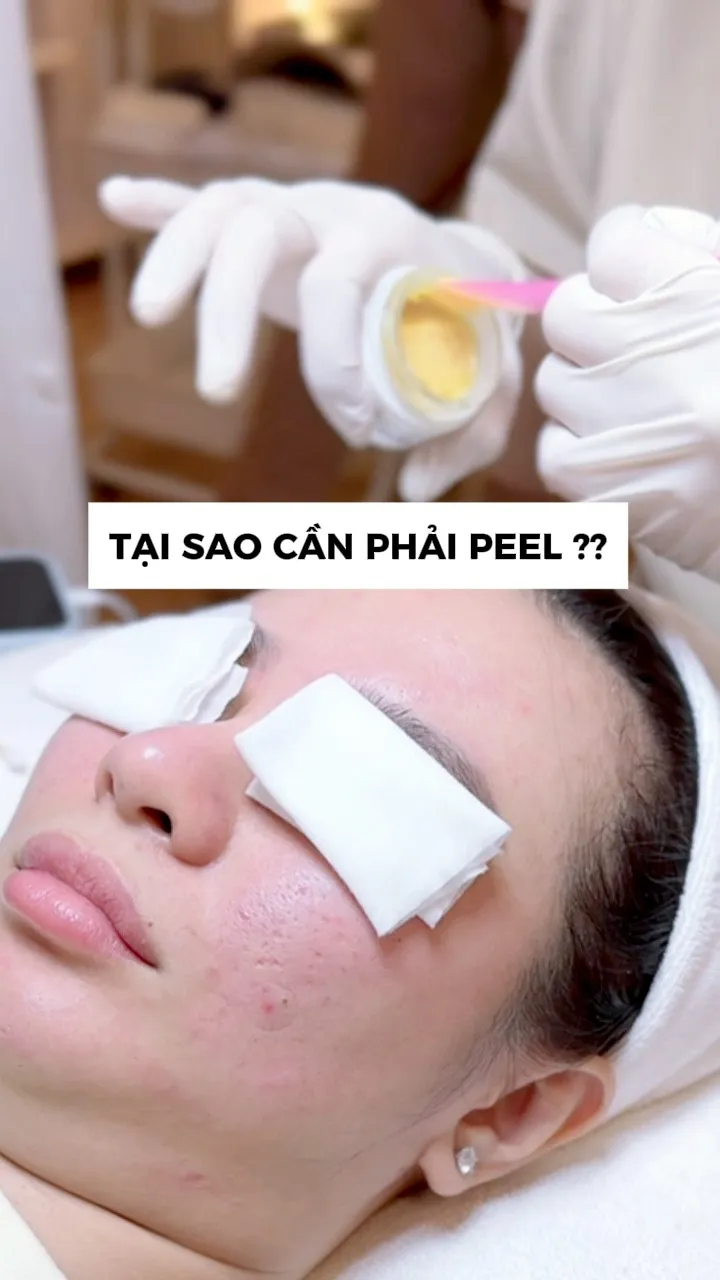 Kỹ thuật viên thao tác quét tinh chất peel lên da mặt khách hàng tại spa, mắt che bông bảo vệ